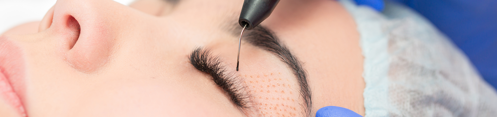 The Plasma IQ Difference with Kimber Arnold