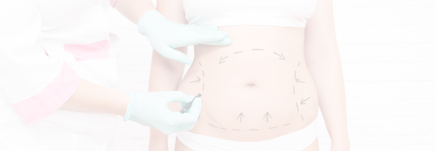 Liposuction