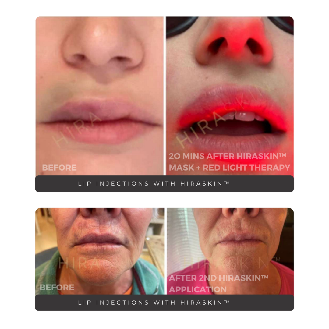 HIRASKIN™ Second Skin Collagen Masks (50)