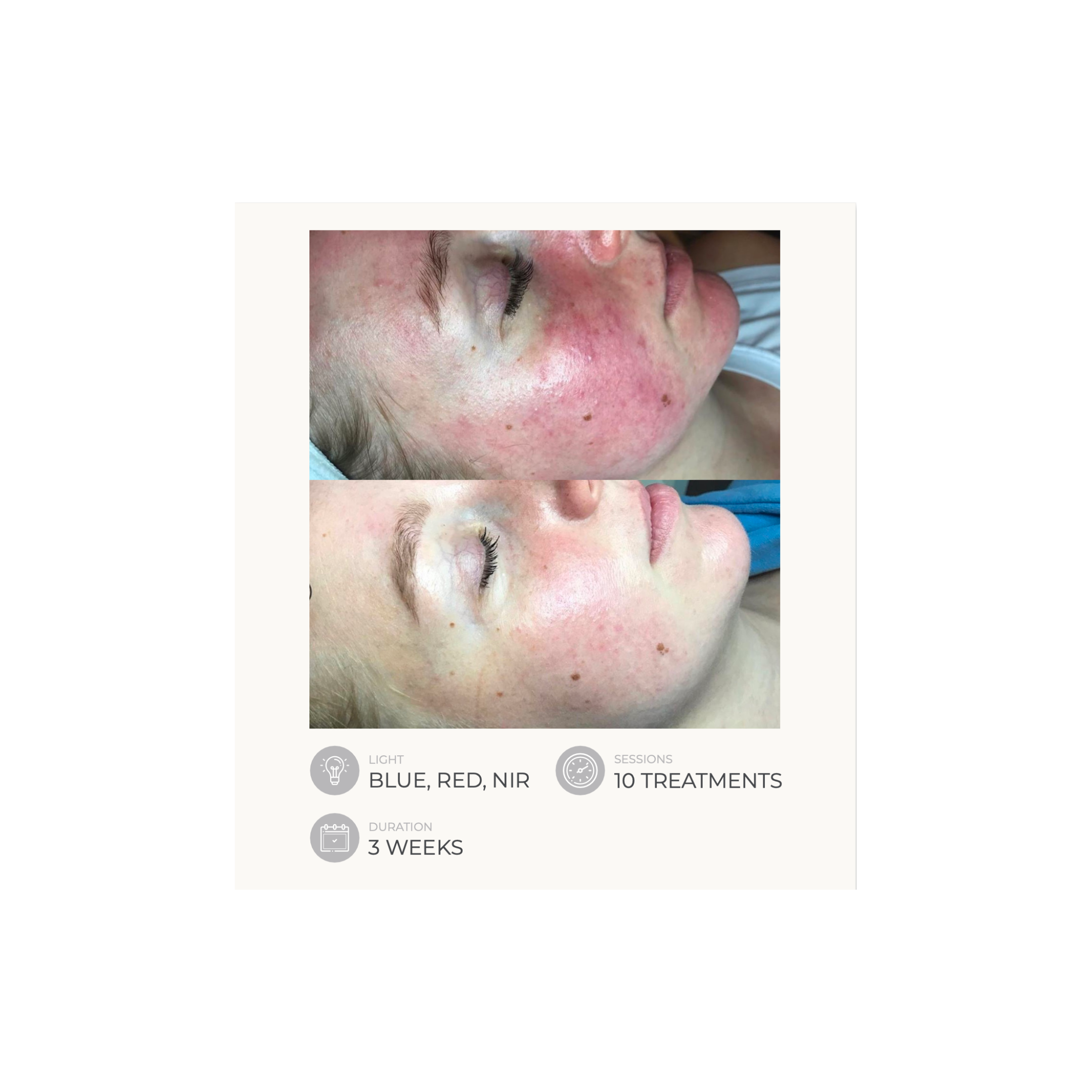 Dermalux Flex MD - Medical Grade LED Light Therapy Device