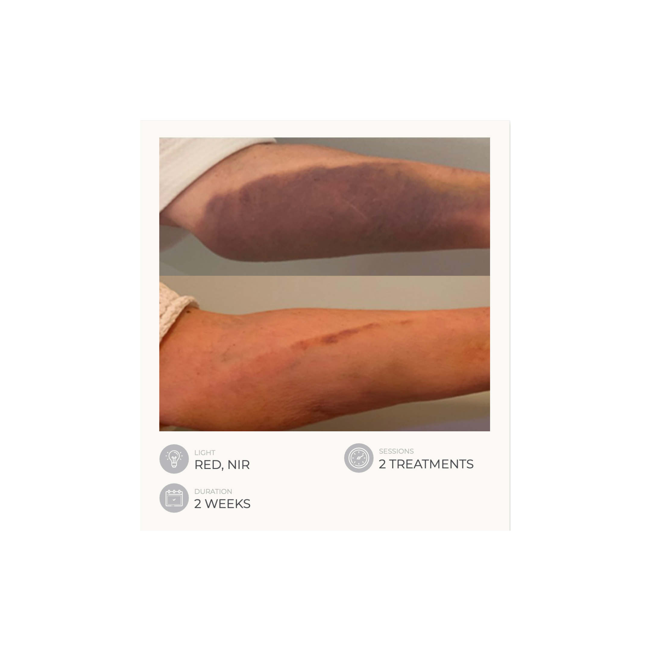 Dermalux Flex MD - Medical Grade LED Light Therapy Device