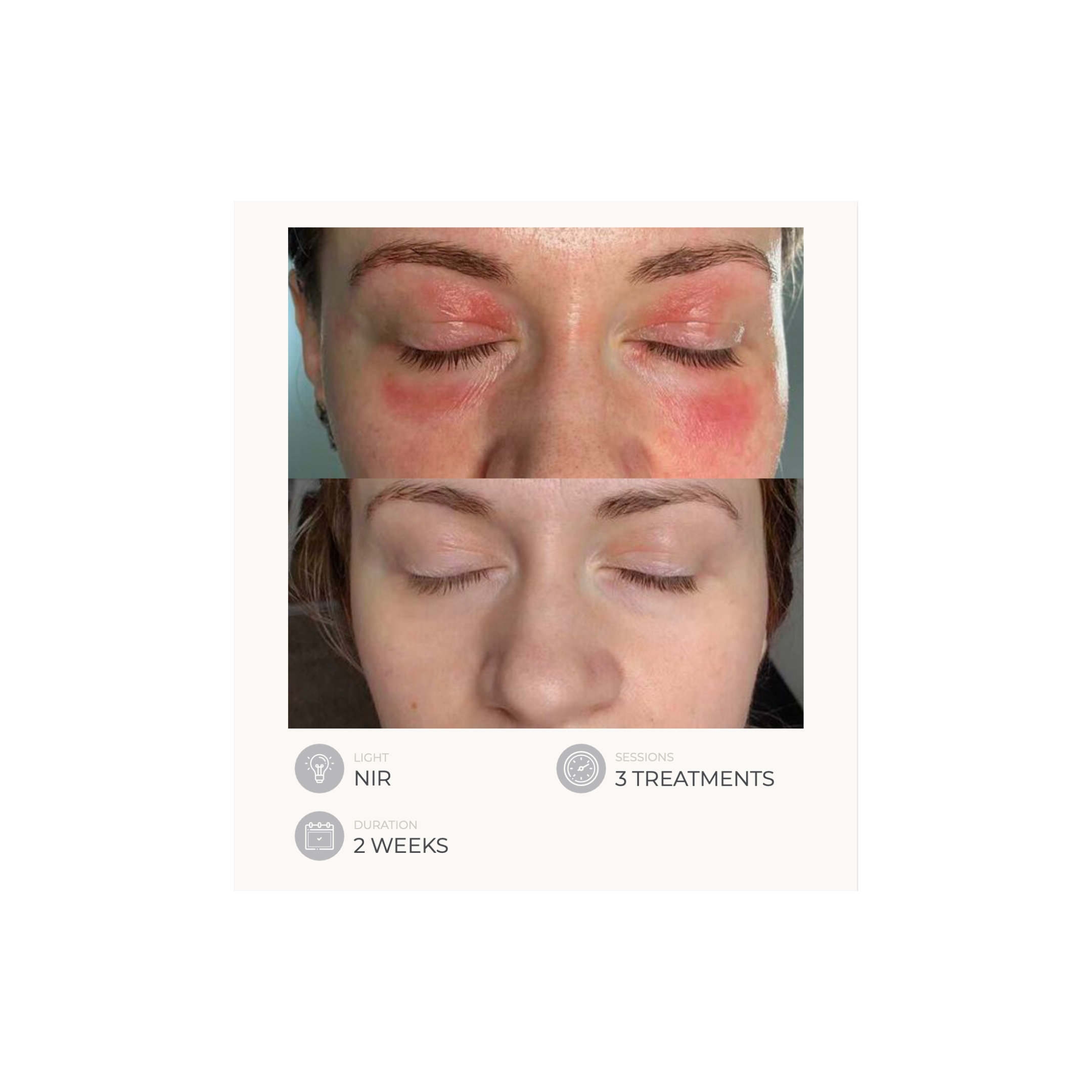 Dermalux Flex MD - Medical Grade LED Light Therapy Device