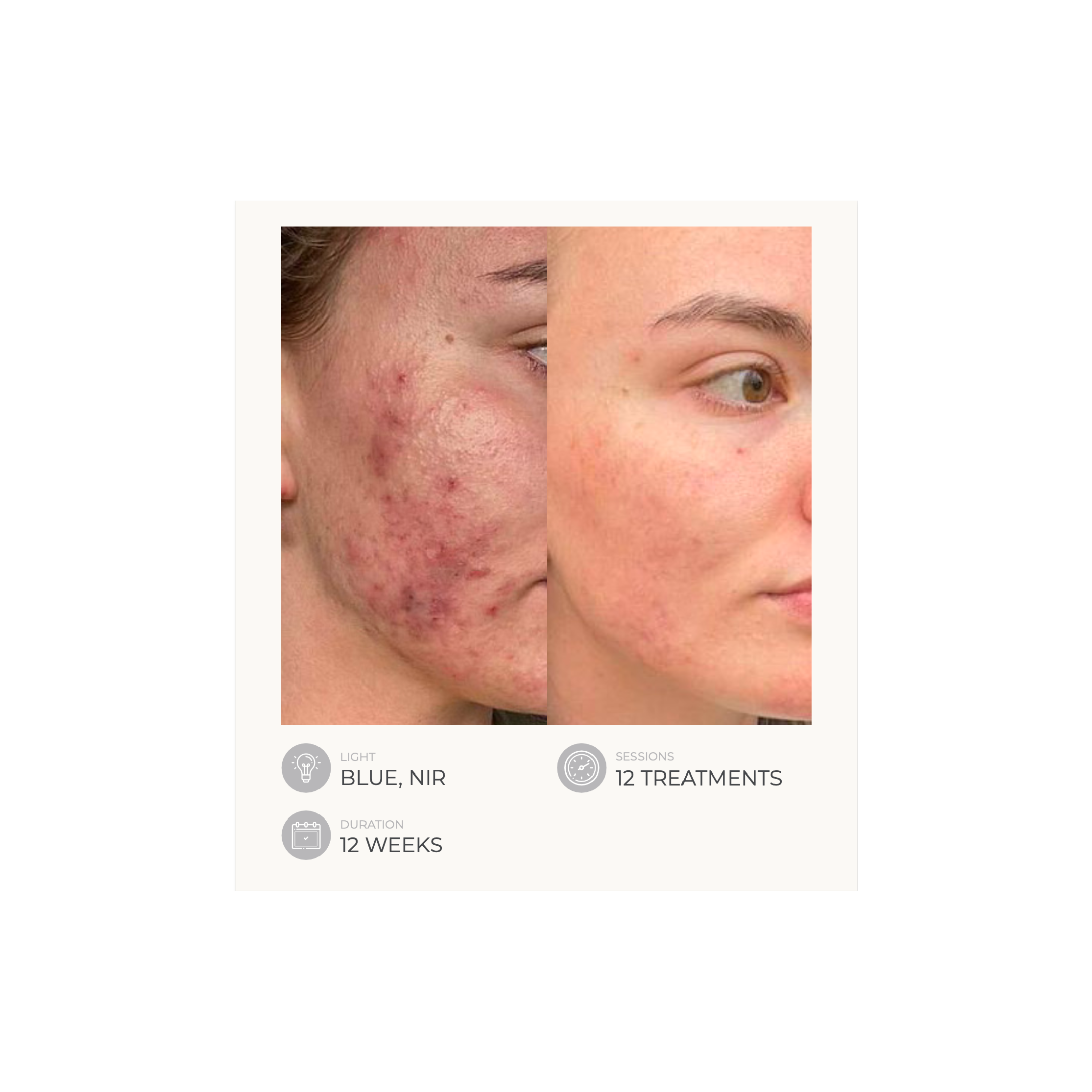 Dermalux Flex MD - Medical Grade LED Light Therapy Device