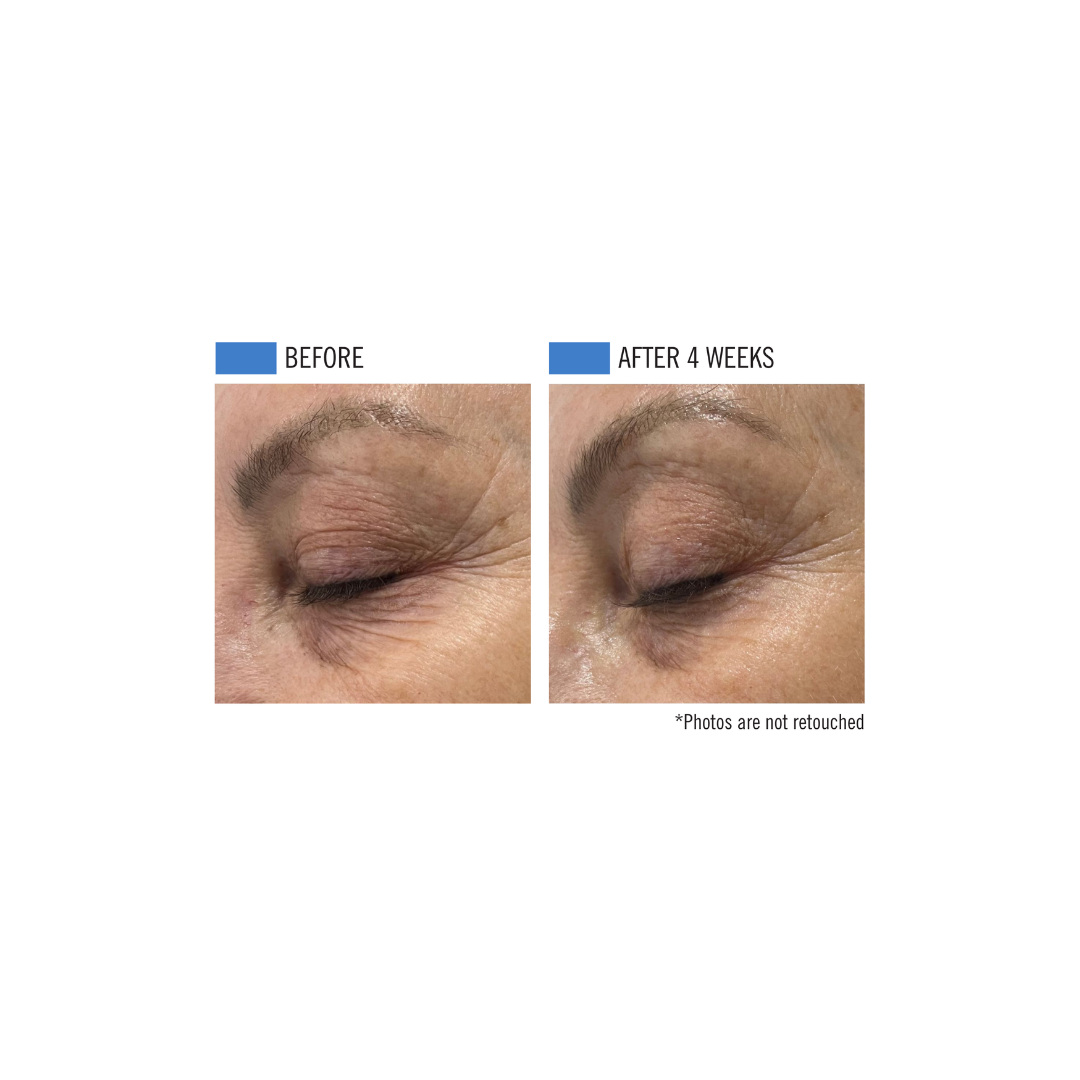 Ultra Adaptive 5-IN-1 Concentrate