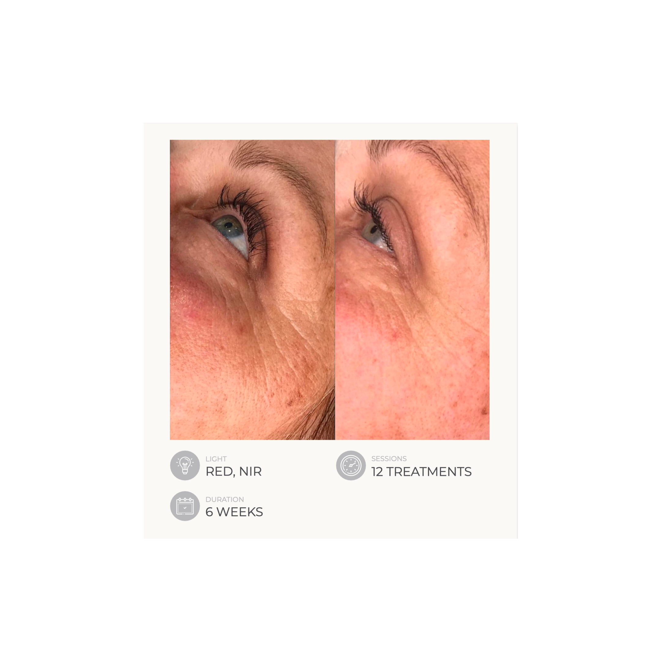 Dermalux Flex MD - Medical Grade LED Light Therapy Device