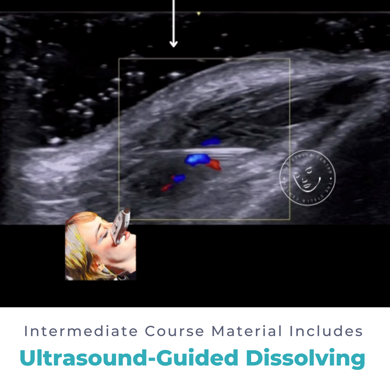 The Stella Center Facial Ultrasound Courses