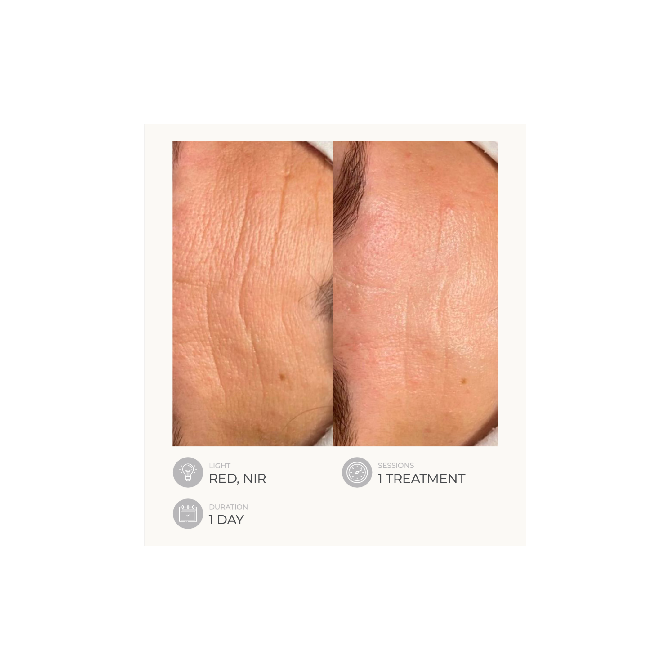 Dermalux Flex MD - Medical Grade LED Light Therapy Device