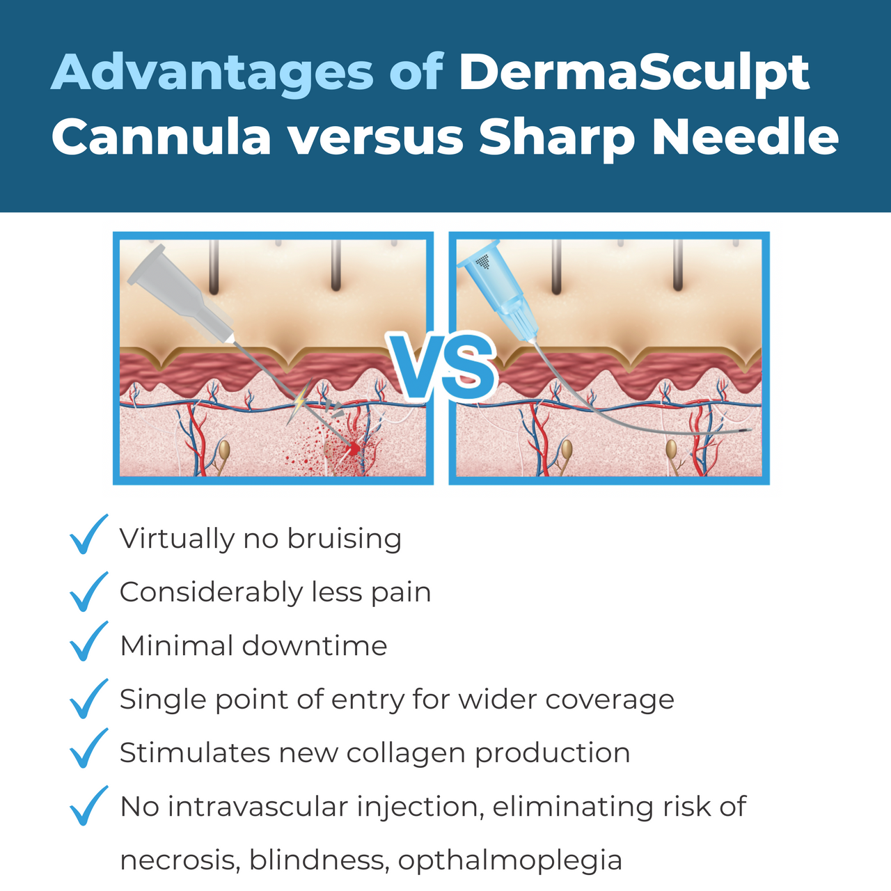 The blunt-tip slides under the skin and does not cut through vessels and tissues, but rather navigates smoothly through the dermis and Sub-Q layer.