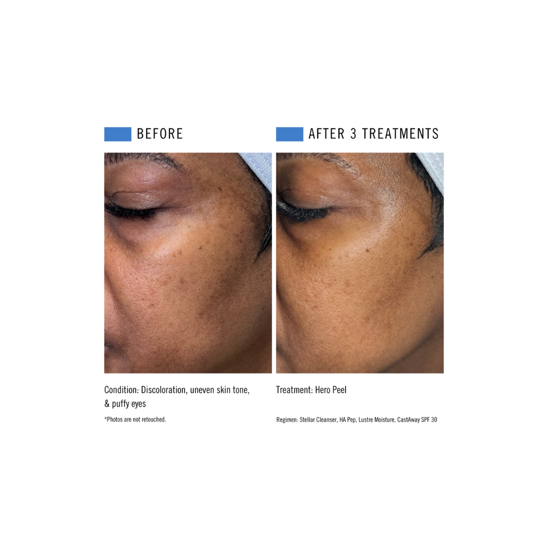 Linder Health Opening Order